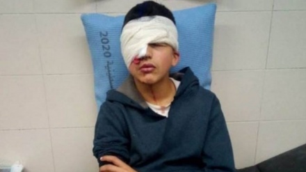 Палестиналық жасөспірім сионистердің пластикалық оғынан бір көзінен айырылды