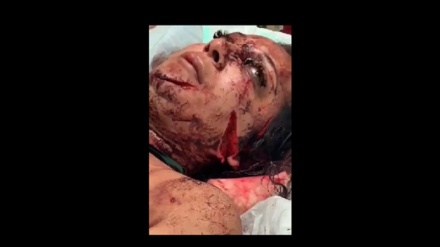 Зымырандық шабуылда қатты жараланған сионист