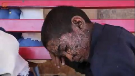 Бен Салман мен Батыс елдерінің йемендік балаларға сыйлығы