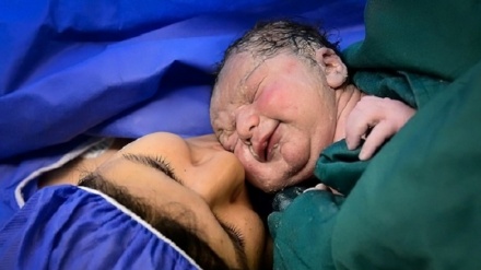 Иран бедеулікті емдеуде әлемдегі ең үздік 10 елдің қатарында